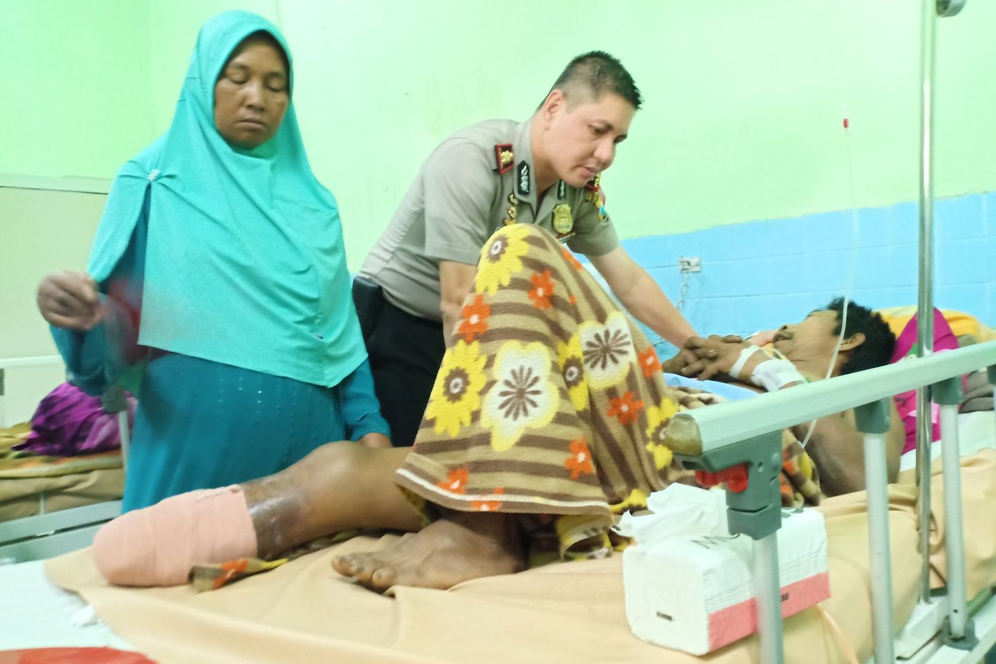 Kaki Korban Ledakan di Probolinggo Diamputasi