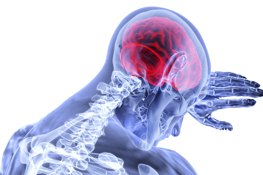 Stroke Juga Rentan Sasar Usia Muda