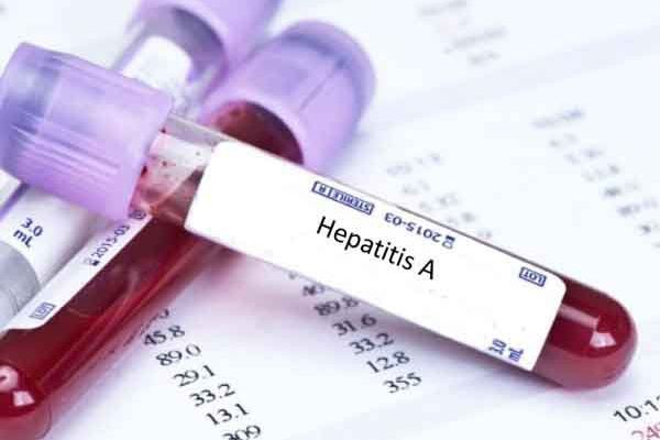 Tren Kasus Hepatitis di Trenggalek Meningkat