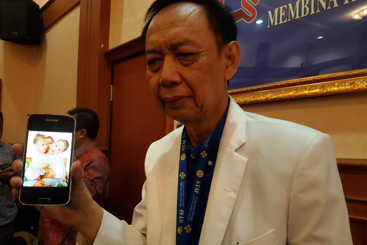 RSUD dr Soetomo Tangani Bayi Kembar Siam dari Kendari