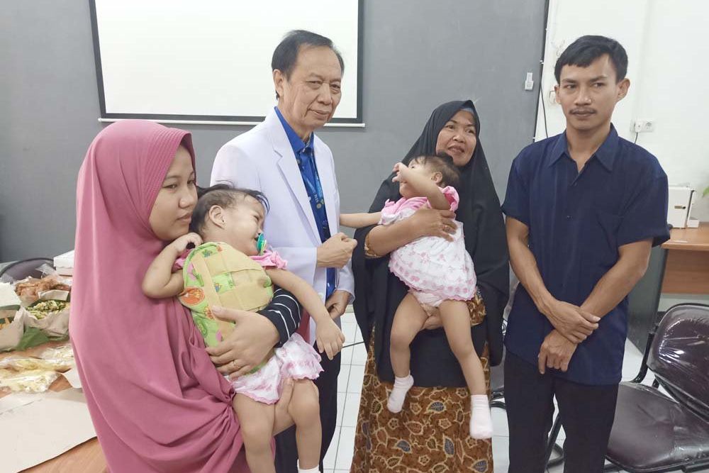 Bayi Kembar Siam Asal Kendari Akan Pulang Oktober Mendatang