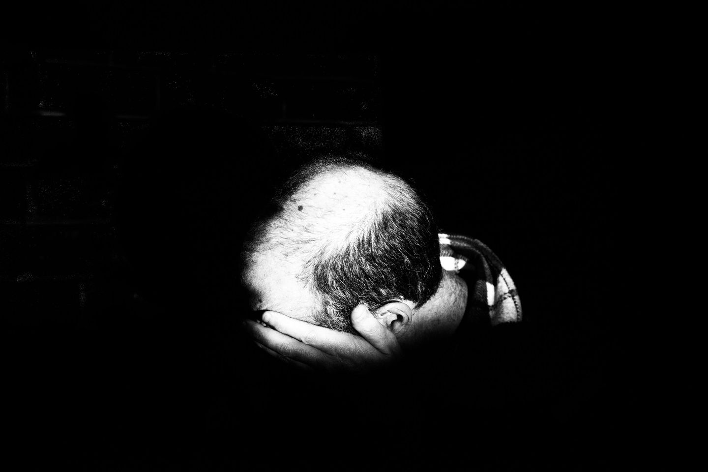 Pola Kebotakan Adalah Penyebab Umum Kerontokan Rambut
