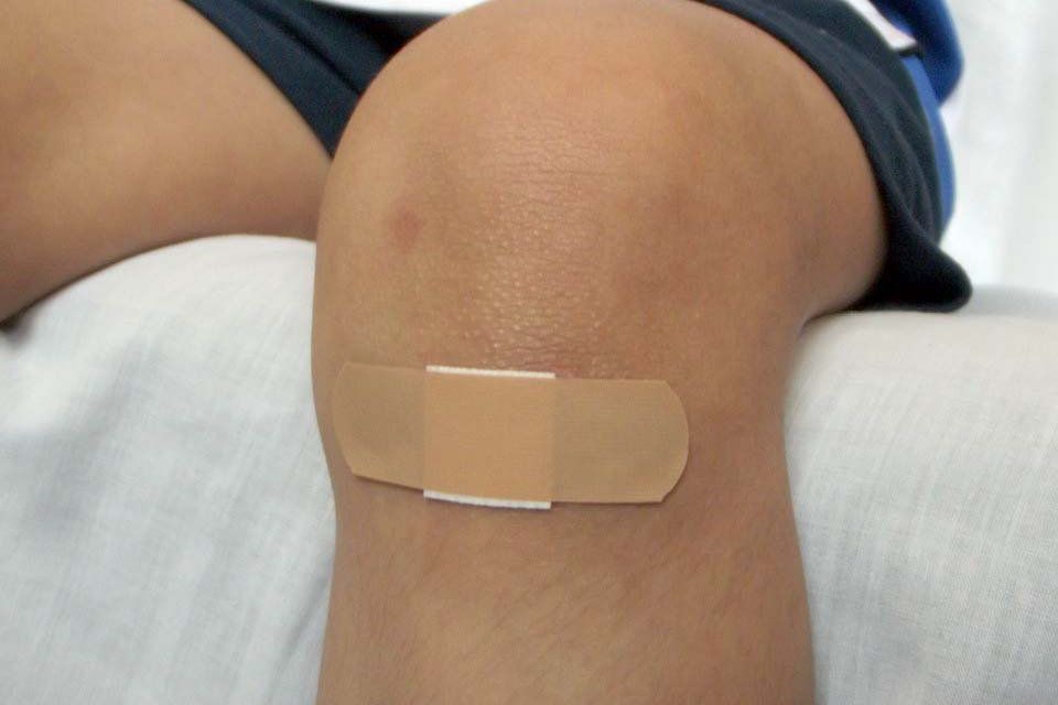 Cara Alami Sembuhkan Luka dengan Cepat