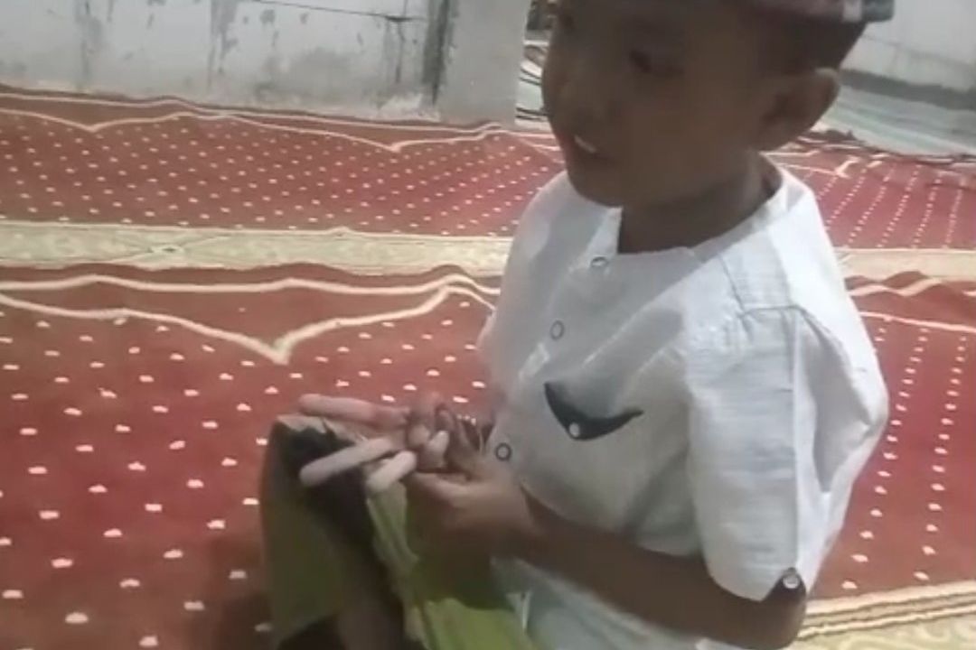 Bocah di Jombang Derita Stunting dan Bocor Jantung, Masih Pakai BPJS Mandiri
