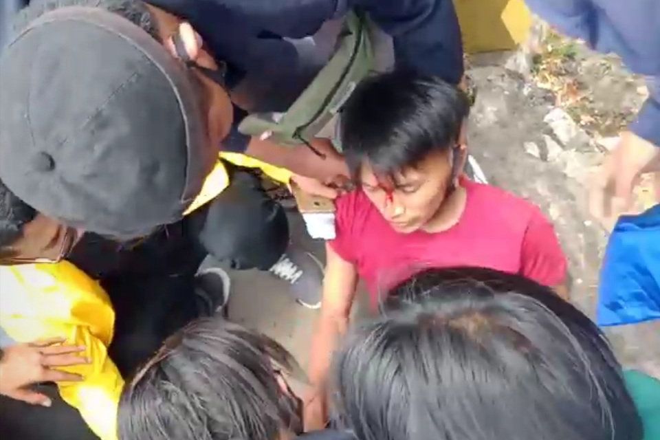 Ini Foto Mahasiswa yang Terluka saat Demo UU Cipta Kerja