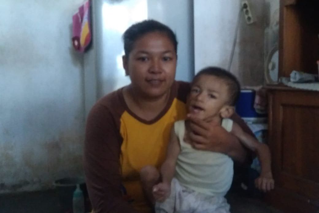 Menderita <em>Cerebral Palsy</em> dan Epilepsi, Balita di Probolinggo Butuh Bantuan