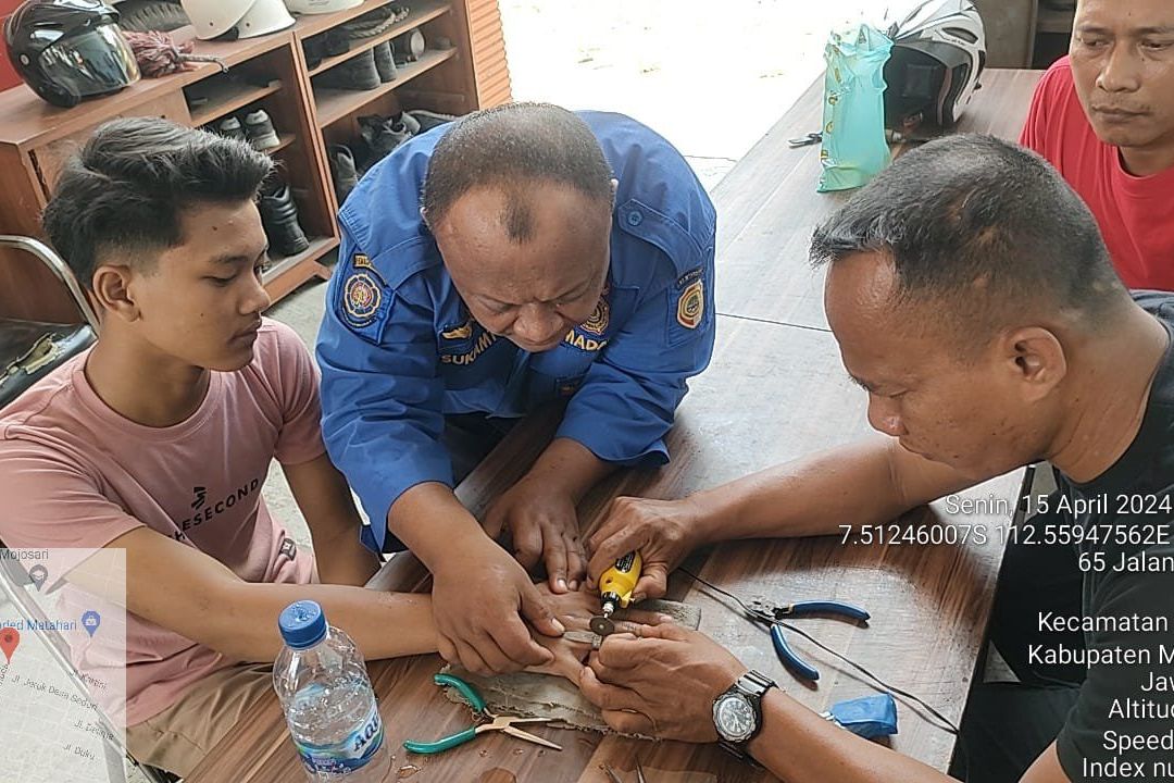 Perjuangan Petugas Damkar Potong Cincin di Jari Remaja