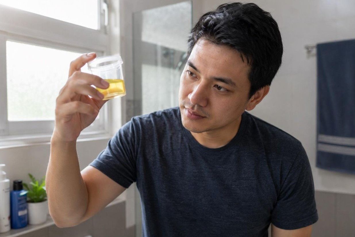 Warna Urine Bisa Jadi Alarm Kesehatan yang Sering Diabaikan