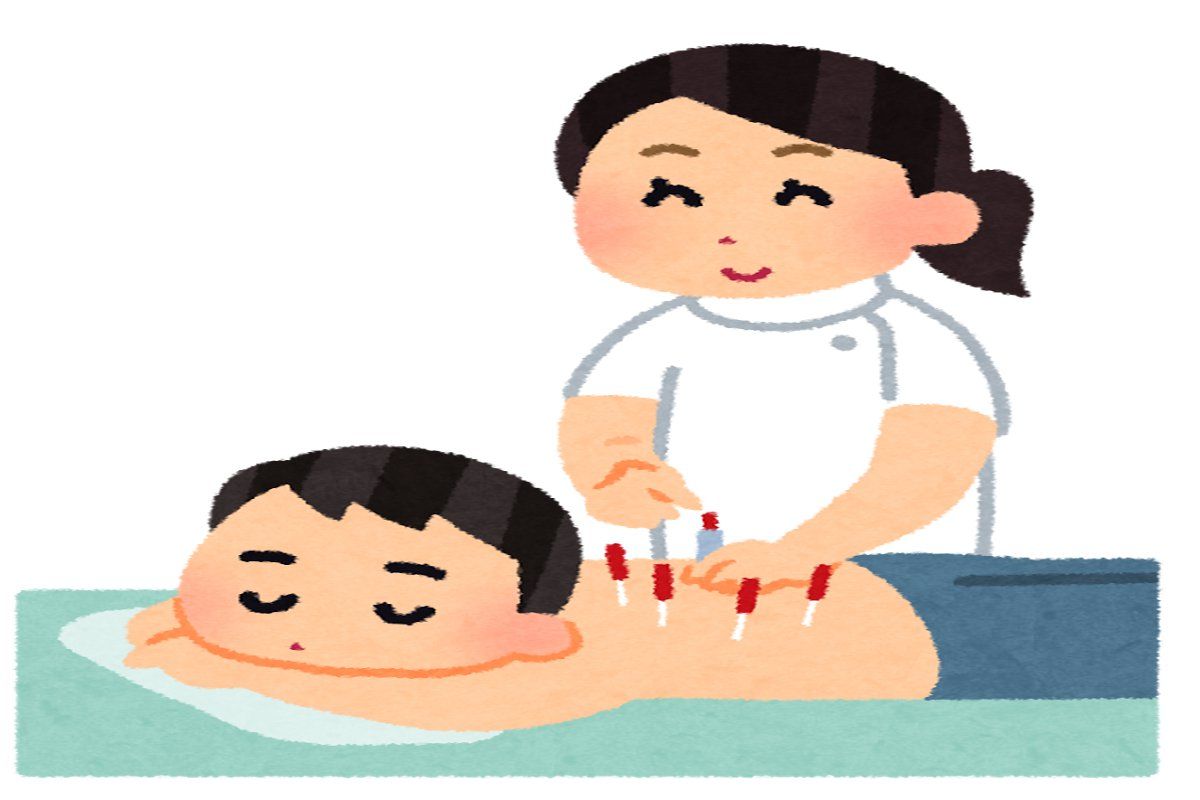 Manfaat di Balik Akupuntur yang Bisa Hilangkan Rasa Sakit