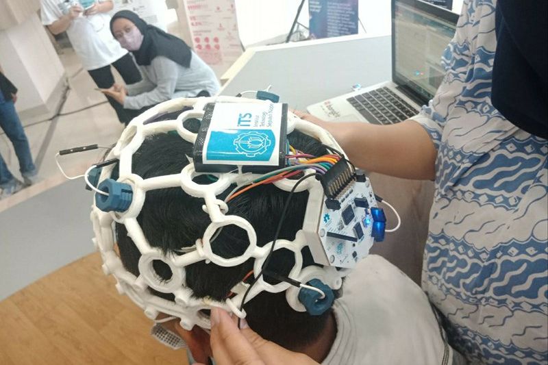 Rehabilitasi Pasien Stroke Lewat Pemantauan Sinyal Listrik Otak