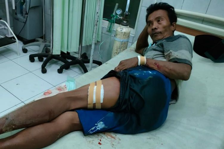 Pulang Dari Hajatan Saudara, Warga Probolinggo Dilempar Bondet Sebanyak 4 Kali