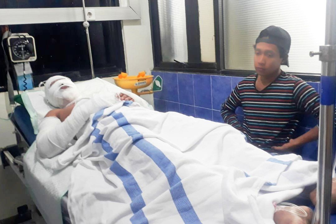 Tabung Elpiji Meledak di Warkop, Tujuh Orang Terluka