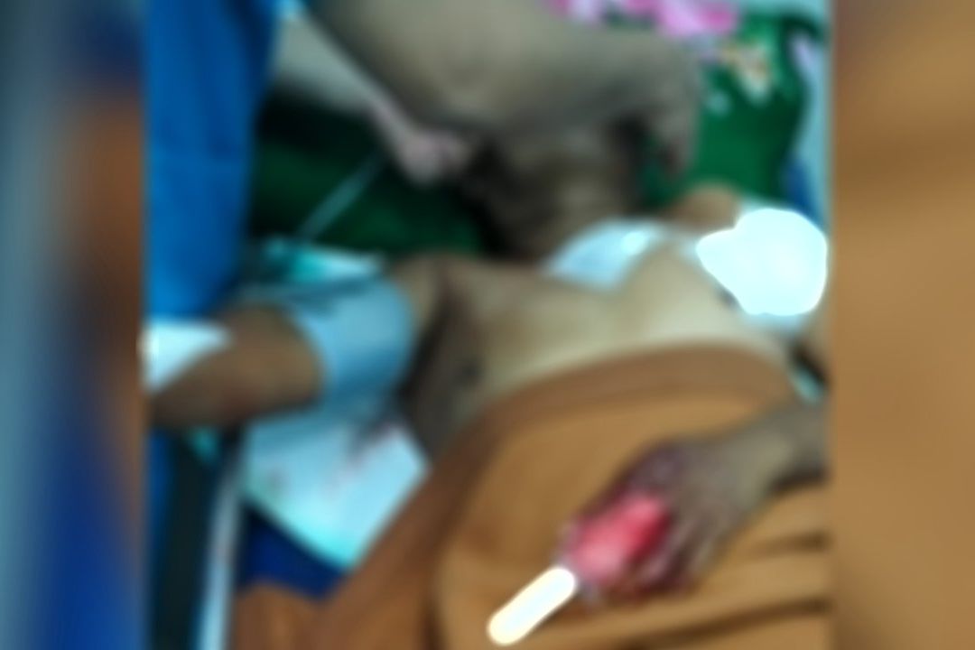 Apess... Tukang Ojek Dibegal dan Dibacok di Jalur Pantura Gending Probolinggo