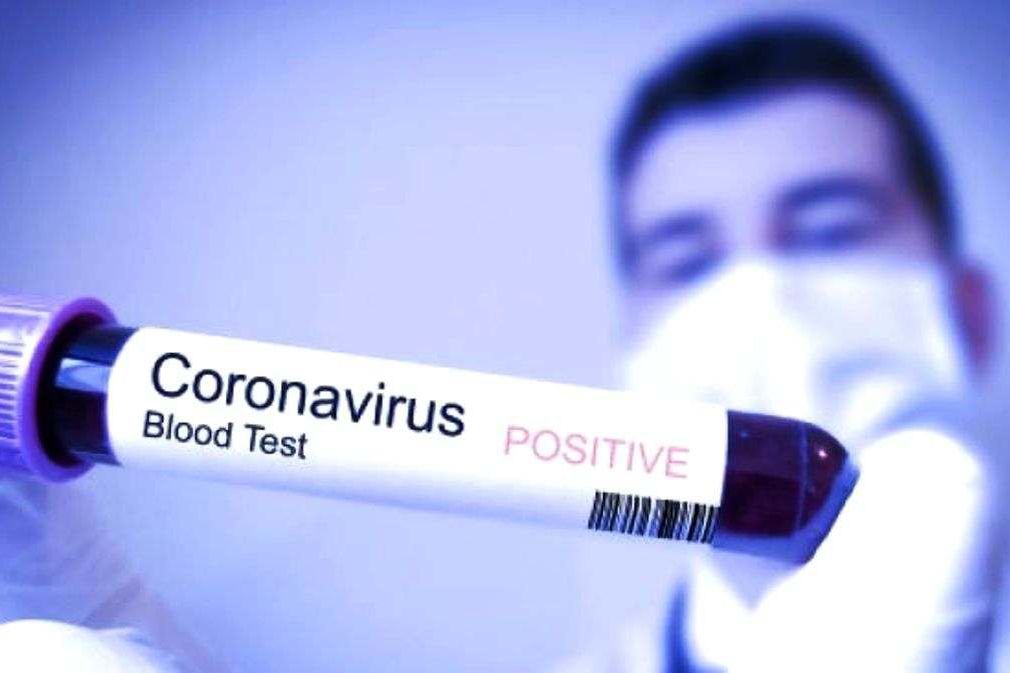 Warga Magetan Meninggal Positif Corona
