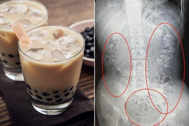 Amankah Teh Mutiara untuk Pencernaan?