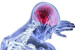 Ini Gejala Stroke Ringan yang Mungkin Tidak Disadari