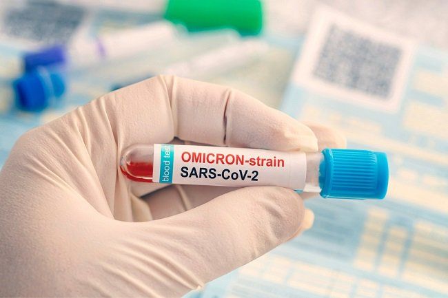 Kasus Omicron Meningkat, Ini Tips Menghadapinya