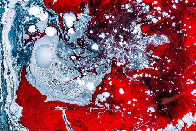 Wabah Ebola Memakan 1000 Korban di Kongo
