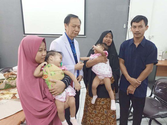Bayi Kembar Siam Asal Kendari Akan Pulang Oktober Mendatang