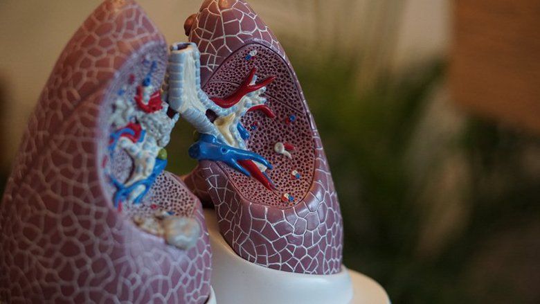 Ilmuwan Temukan Tes Darah Baru untuk Deteksi Dini Kanker Paru-paru