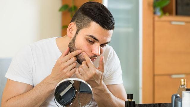 Ini Penyebab Cowok Jerawatan