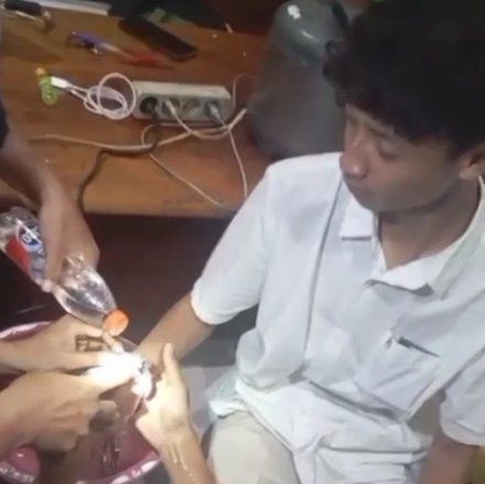 Mainan Borgol Milik Kakak, Tangan Anak di Lamongan Terborgol 