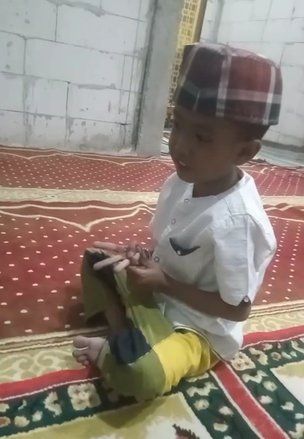 Bocah di Jombang Derita Stunting dan Bocor Jantung, Masih Pakai BPJS Mandiri