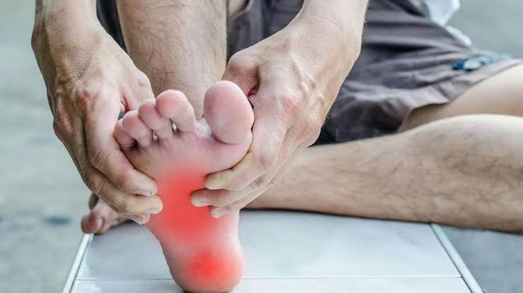Ini Penyakit yang Menyebabkan Telapak Kaki Sakit