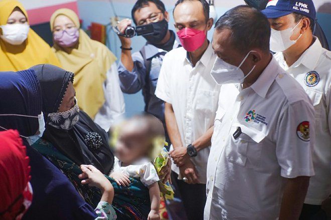 Kenzo, Balita Penderita Hidrosefalus Telah Ditangani RS Unair
