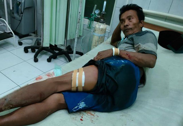 Pulang Dari Hajatan Saudara, Warga Probolinggo Dilempar Bondet Sebanyak 4 Kali