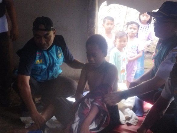 Remaja di Jember Dipasung 1,5 Bulan Usai Ayah Meninggal, Sempat Cekik Ibu dan Lempari Warga