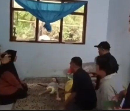 Wartawan Bantu Keluarga Balita Sindrom Proteus