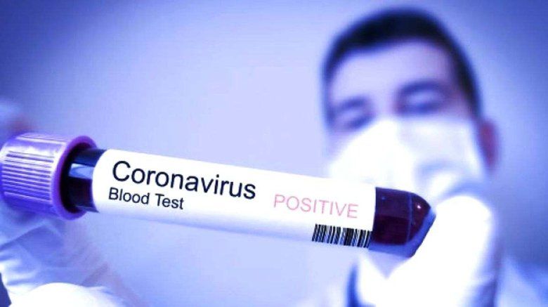 Dinkes Gresik Edarkan Surat Kewaspadaan Terkait Virus Corona