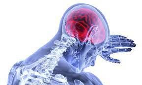 Stroke Ringan, Tanda Bahaya yang Sering Dianggap Biasa