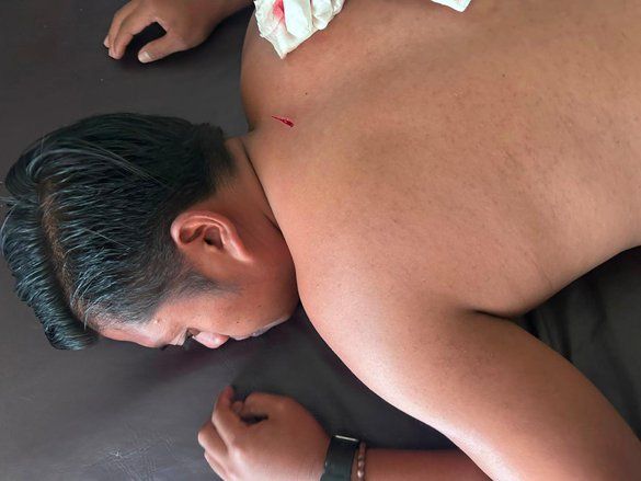 Guru Honorer SDN 3 Bantaran Probolinggo Disabet Celurit saat Bertugas