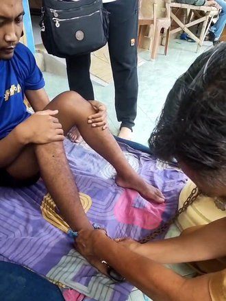 5 Tahun Dipasung Keluarga, Pemuda Jember Akhirnya Dibebaskan