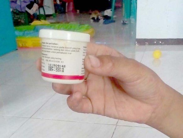 Dinkes Kabupaten Mojokerto Tak Beri Tindakan Petugas Pemberi Salep Kedaluwarsa