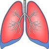 Polusi Udara Berkaitan dengan Kanker Paru