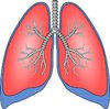 Polusi Udara Berkaitan dengan Kanker Paru