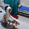 Diduga Usai Makan Es Smoket, Anak di Ponorogo Harus Menderita Luka Bakar