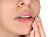 Jangan Disepelekan, Bibir Pecah-pecah Bisa Jadi Tanda Diabetes