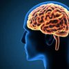 Faktor Gaya Hidup Memengaruhi Kesehatan Otak